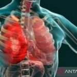 Otoritas Rusia sebut tak ada risiko epidemi kasus pneumonia di Irkutsk